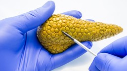 rak trzustki zaczyna się wcześniej, niż sądzono. naukowcy odkrywają ro