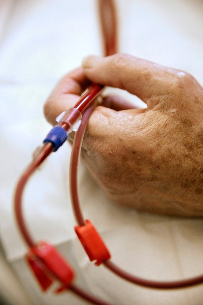 Žene lošije prolaze na dijalizi od muškaraca i tada više pate od depresije