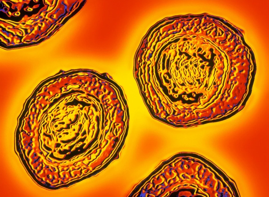 Bakterija pertusis, uizazivač velikog ili magarećeg kašlja