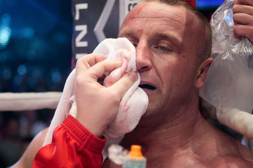 Pudzianowski ze śliwą pod okiem. Foto