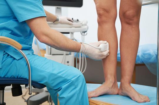 Otok noge praćen bolom najčešće je prvi znak tromboze dubokih vena 