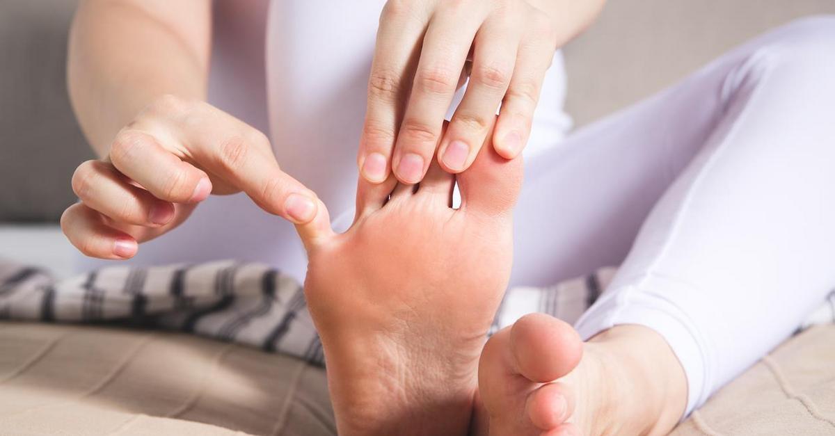 Nagniotki na małych palcach u nóg – jak sobie z nimi radzić?