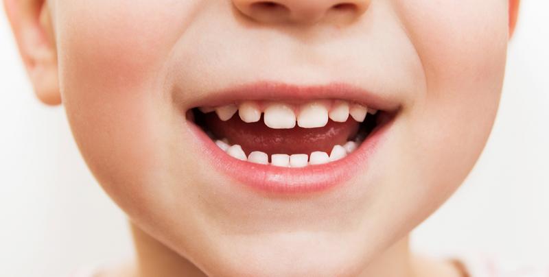 Chcesz, żeby dziecko miało proste zęby? Nie przegap tych objawów