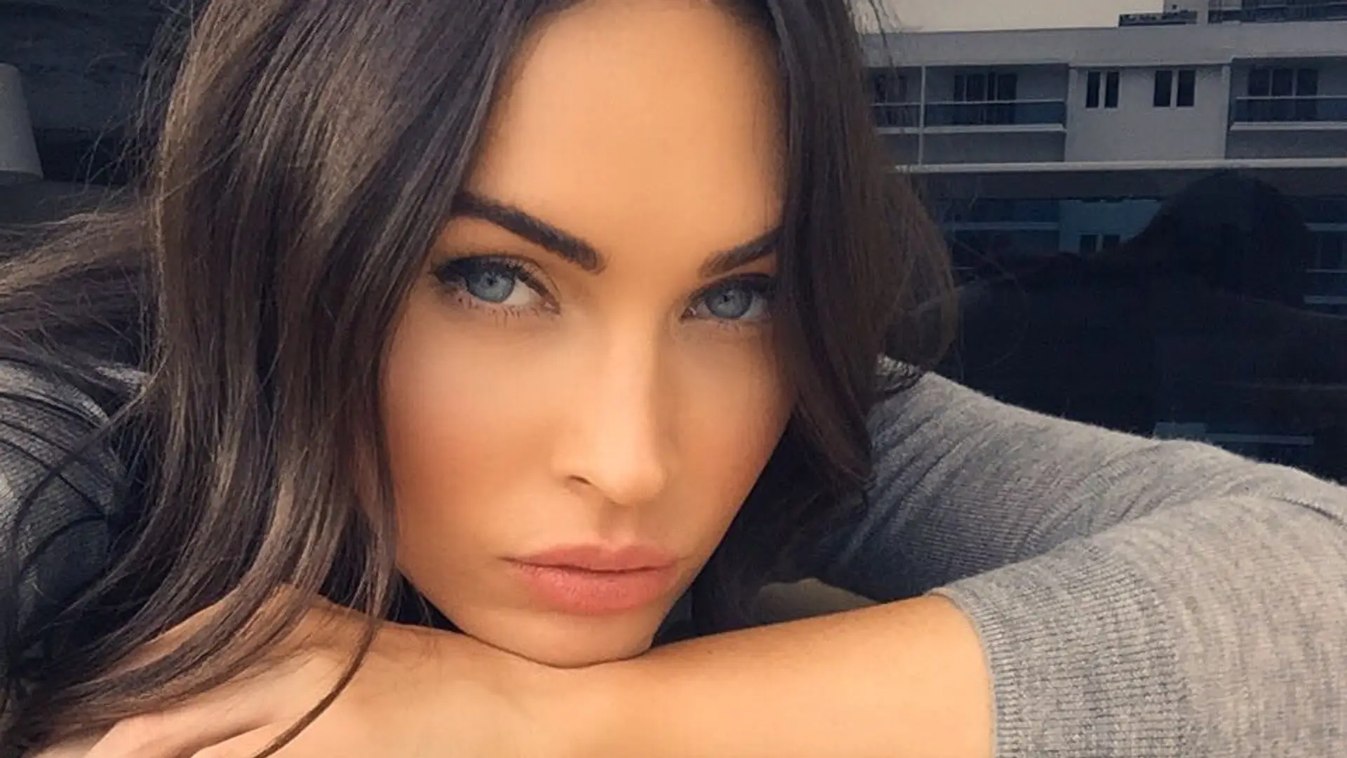 Megan Fox choruje na brachydaktylię. Co to za choroba?