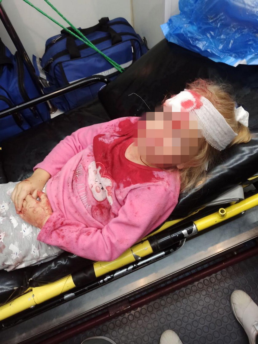 Szokujące sceny na Białorusi. Pięcioletnie dziecko padło ofiarą milicji