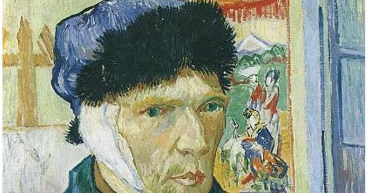 Vincent Van Gogh This might be the reason famous artist