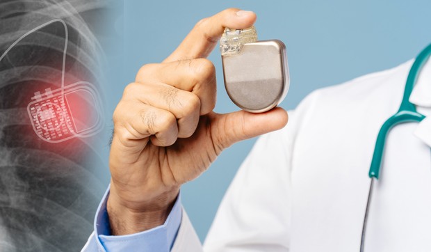 Implantabilni kardioverter-defibrilator (ICD) je mali uređaj koji stalno nadgleda srčani ritam i automatski daje elektrošokove u slučaju opasnih aritmija