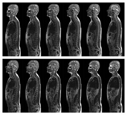 Nerka 500 razy droższa niż żołądek. Ceny organów na czarnym rynku