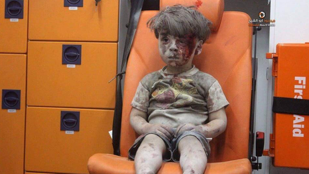 Chłopiec ranny w Aleppo