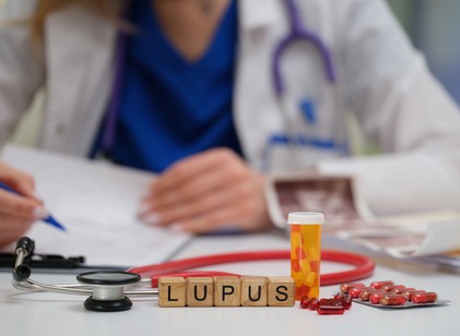 A nagy imitátor: a lupus korai tünetei, amelyeket soha ne hagyjon figyelmen kívül című cikk nyitóképe