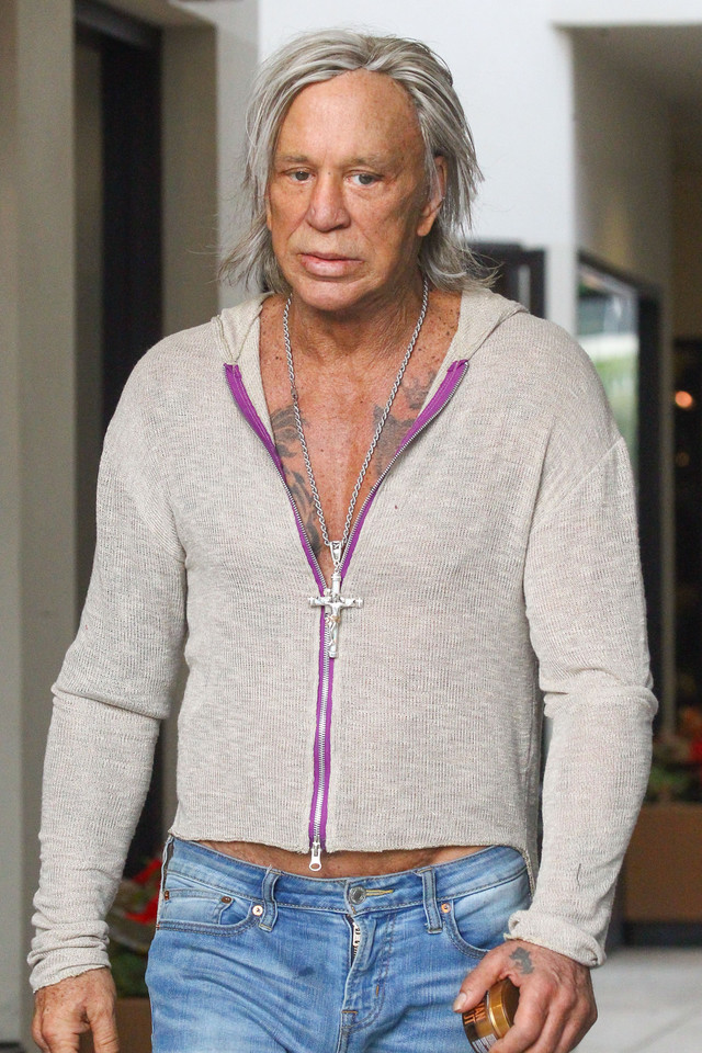 Ofiary operacji plastycznych: Mickey Rourke