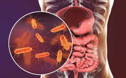 Mutációs mintázatok: a rák és a stroke kialakulásában is döntő szerepet játszik a mikrobiom