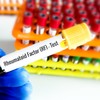 Reumatoidni faktor se testira pomoću analize krvi