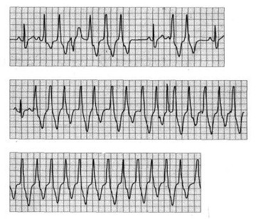 ekg2-d00000FCE56e7f2c05198