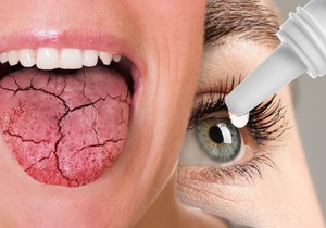 Suva usta i suve oči