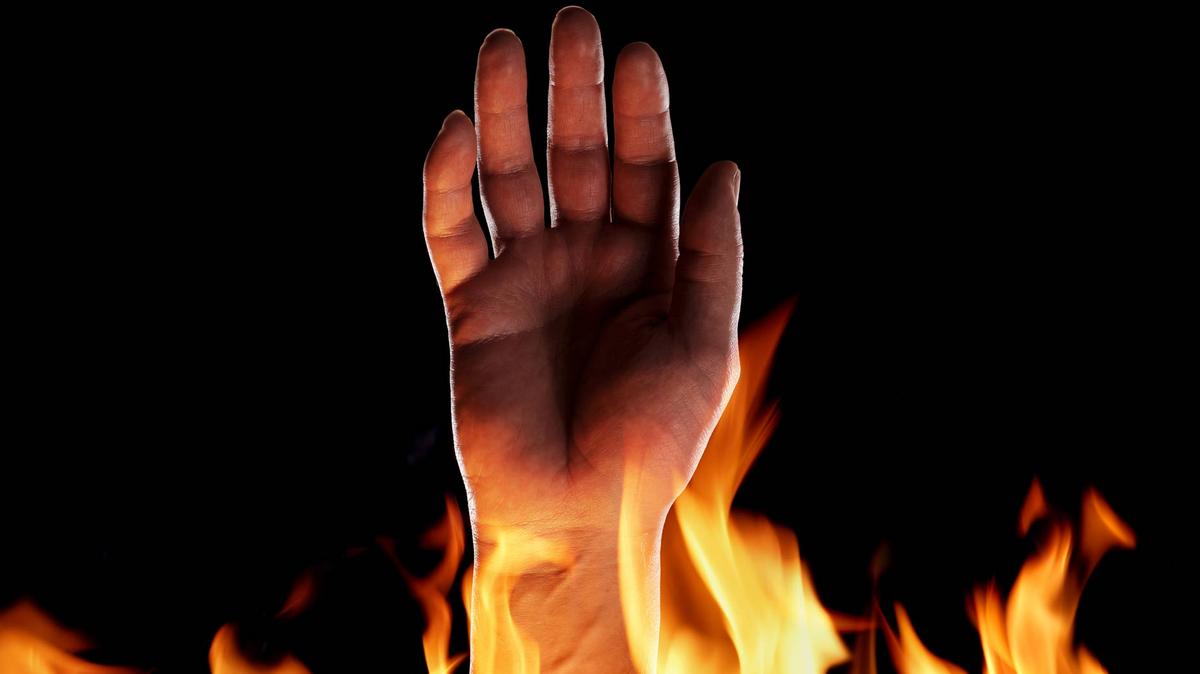 Burning finger