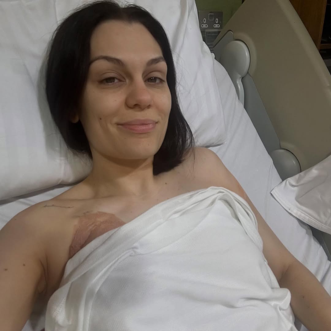 Jessie J a fost operată de cancer la sân. Mesajul transmis de cântăreață de pe patul de spital: „Aștept rezultatele”
