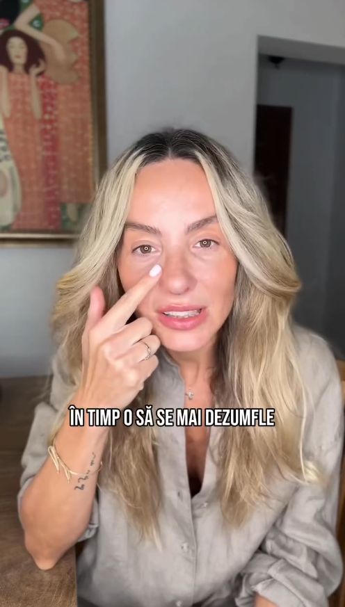 Reacția Flaviei Mihășan când și-a văzut nasul la 12 zile de la intervenție