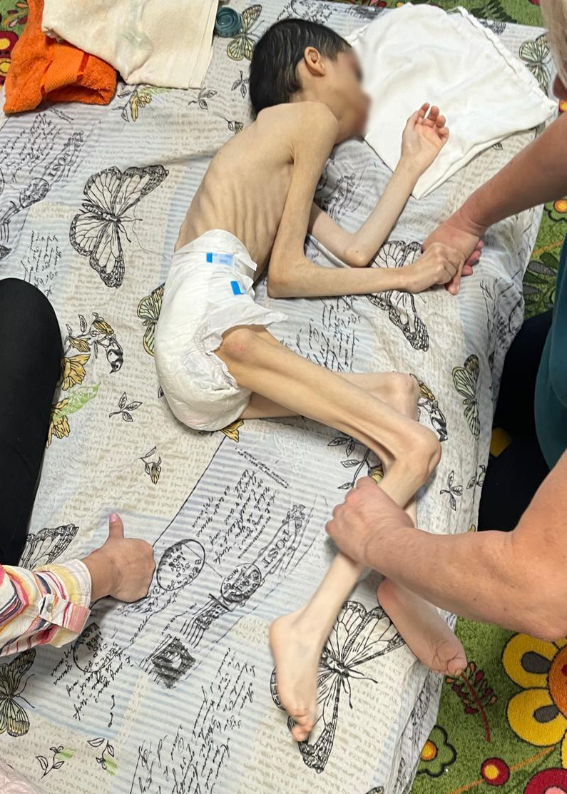Imagini greu de privit din centrele unde copiii cu dizabilități erau ținuți încuiați cu zăvoare, ca să nu iasă din camere, în Mureș