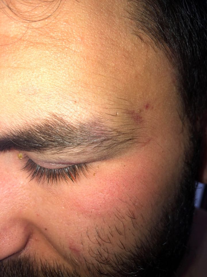 Trei ploieșteni aflați în auto-izolare la domiciliu povestesc cum au fost agresați fără motiv de polițiști. Reacția IPJ Prahova