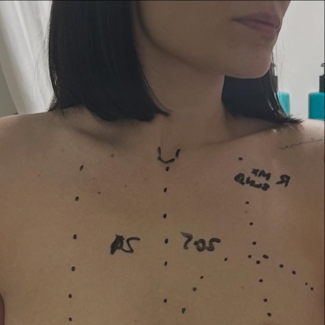 Jessie J a fost operată de cancer la sân. Mesajul transmis de cântăreață de pe patul de spital: „Aștept rezultatele”