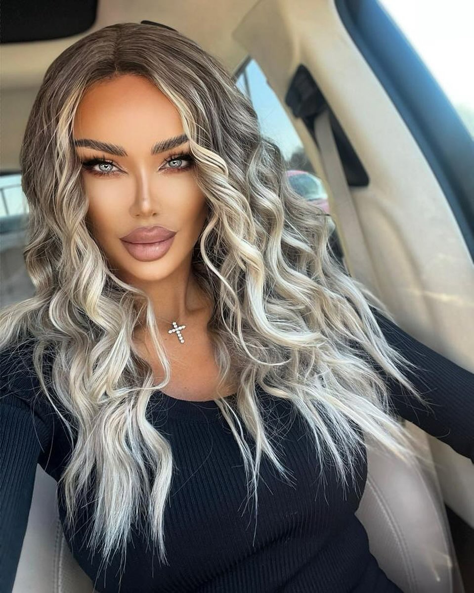 Bianca Drăgușanu recunoaște că a exagerat cu intervențiile estetice: „Eram obișnuită cu o formă gigantică, urâtă a buzelor”