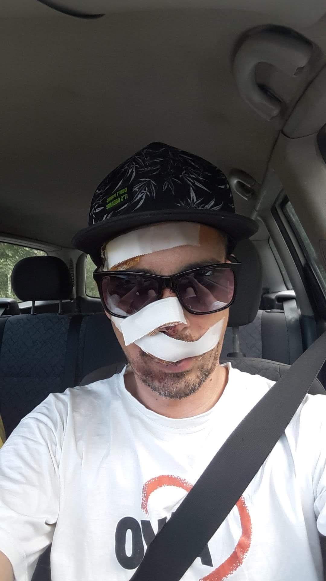 Domnule primar Robu, aveți grijă când mergeți cu bicicleta prin Timișoara! Puteți ajunge așa, ca tânărul care a căzut în groapa de pe trotuar