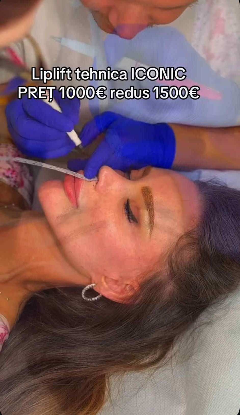 Bianca Drăgușanu și-a făcut o nouă operație estetică la față. Cât costă procedura chirurgicală care e gata în 30 de minute: „Va fi wow”