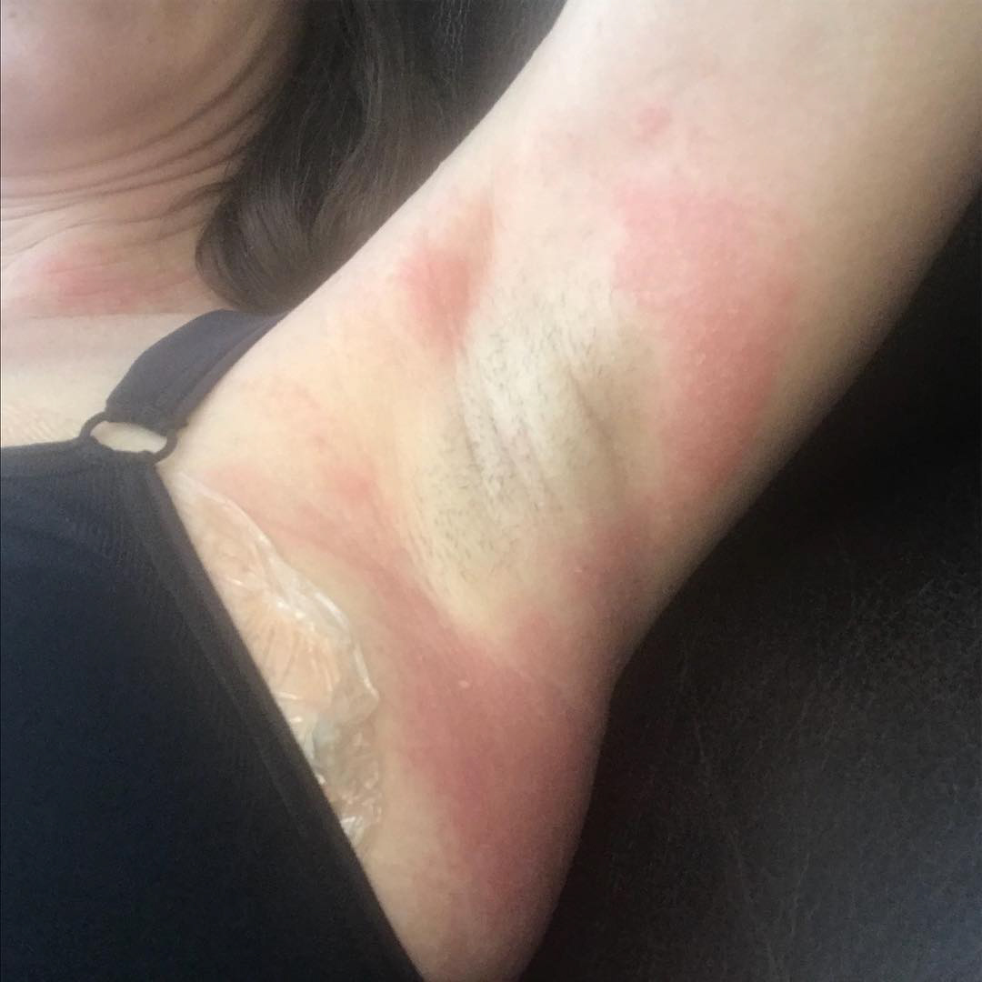 O mamă s-a ales cu o boală nouă după ce a făcut o operație "la modă" printre femei: "Dacă știam că poate provoca atâta durere, n-o mai făceam niciodată"