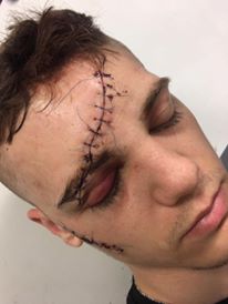 FOTO | Un tânăr a fost mutilat de o gașcă de huligani. Mesajul uluitor, devenit viral, către cei care l-au desfigurat