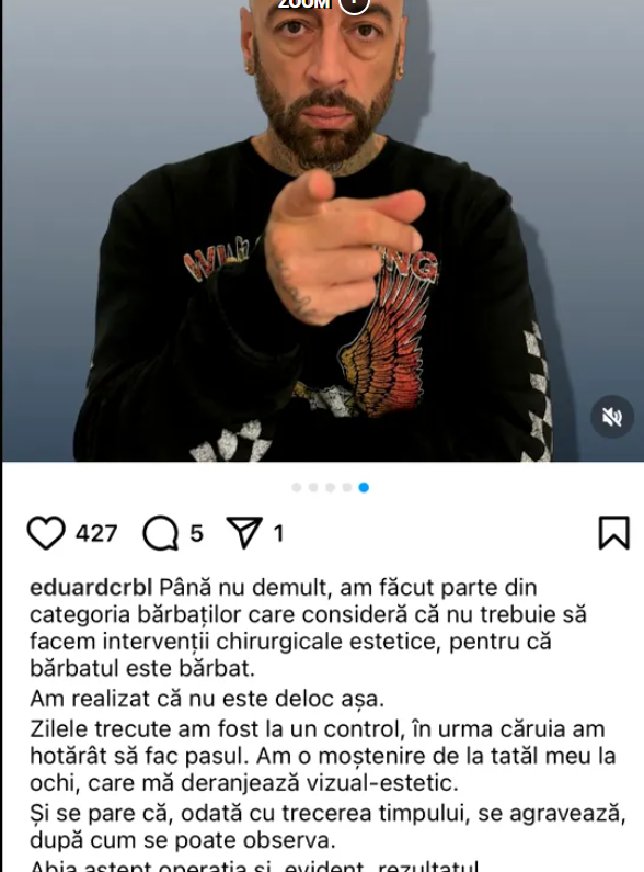 CRBL își face prima intervenție estetică. De ce a luat această decizie. „Se pare că, odată cu trecerea timpului, se agravează”