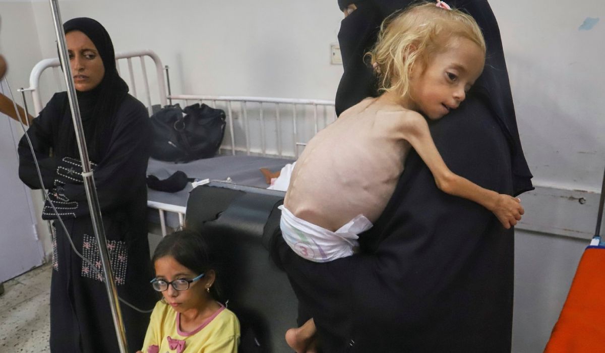 Povestea fetiței de 2 ani evacuată din Gaza și salvată de medici în Italia în ultimul moment: cântărea doar patru kilograme