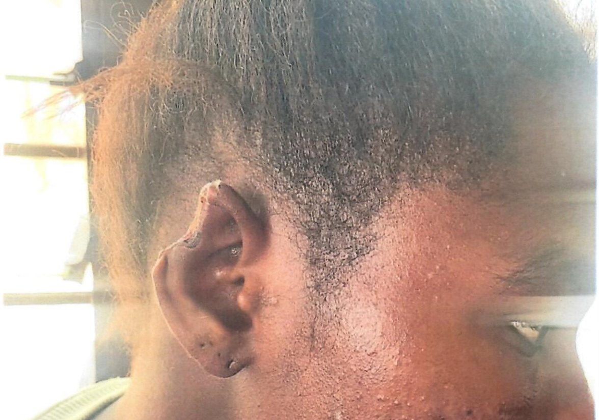 Lawyer appeals to IGP over alleged police brutality: Suspect\'s ear severed in custody