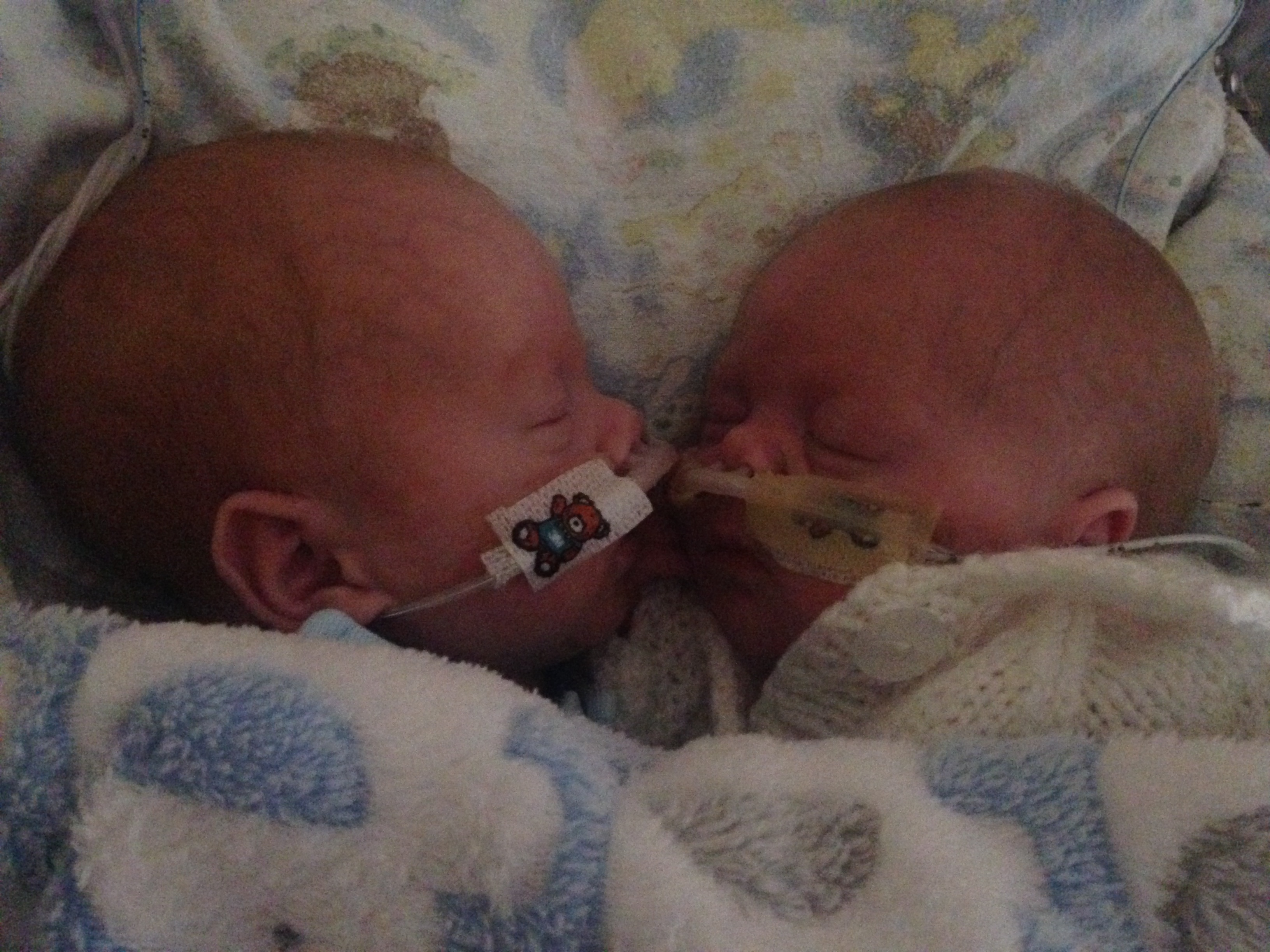 Doi frați gemeni născuți prematur au supraviețuit după ce au fost puși în același incubator. Ce s-a întâmplat când s-au îmbrățișat | FOTO