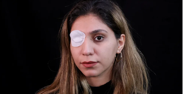 Fețele rezistenței. Tinerii arată cât de brutal este regimul din Iran: „Ne-ați împușcat în ochi și ne-ați luat vederea, dar inima încă ne bate”