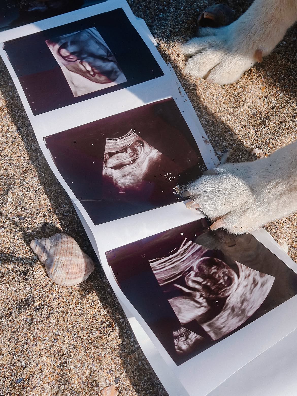 Ramona Păun, imagini cu primele ecografii din sarcină 