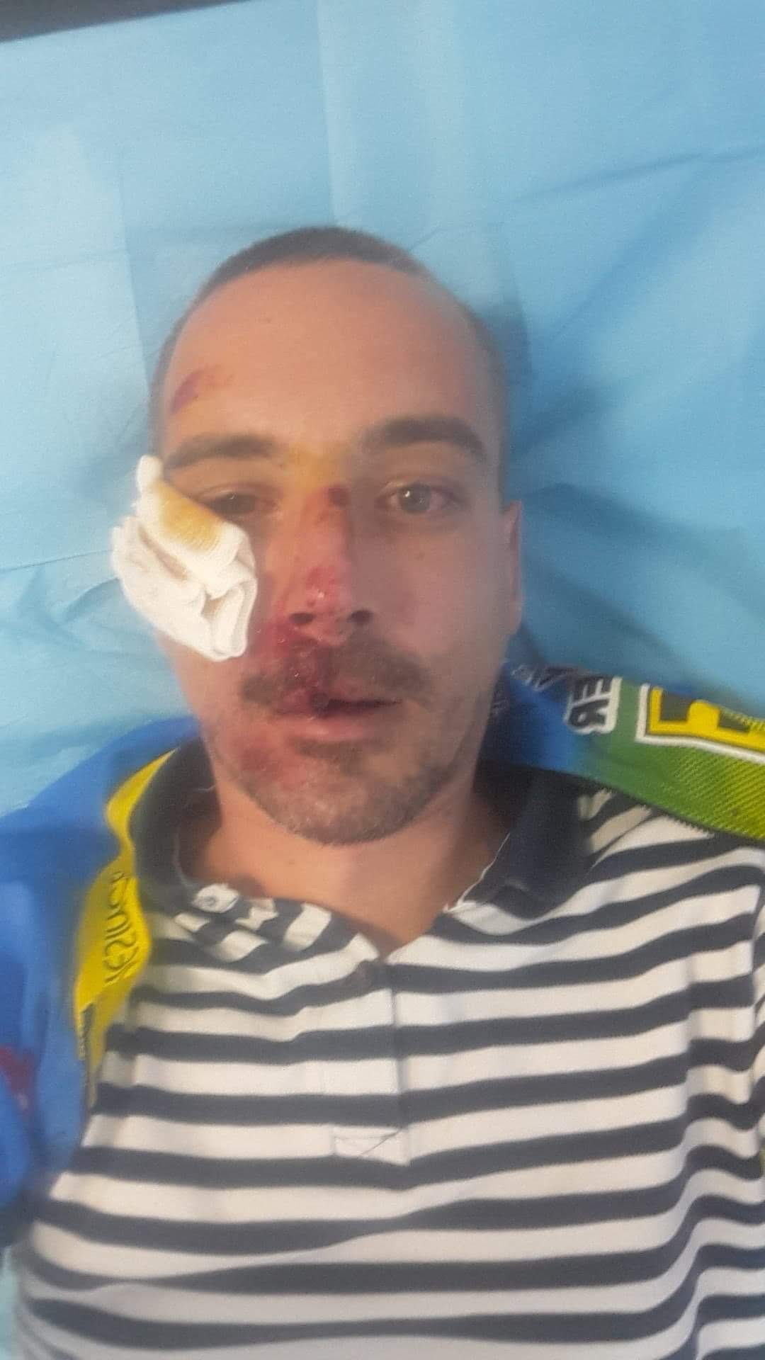 Domnule primar Robu, aveți grijă când mergeți cu bicicleta prin Timișoara! Puteți ajunge așa, ca tânărul care a căzut în groapa de pe trotuar