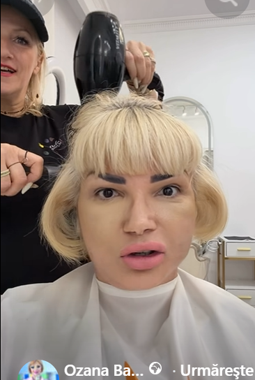 Transformarea Ozanei Barabancea, la o lună după operația de lifting facial