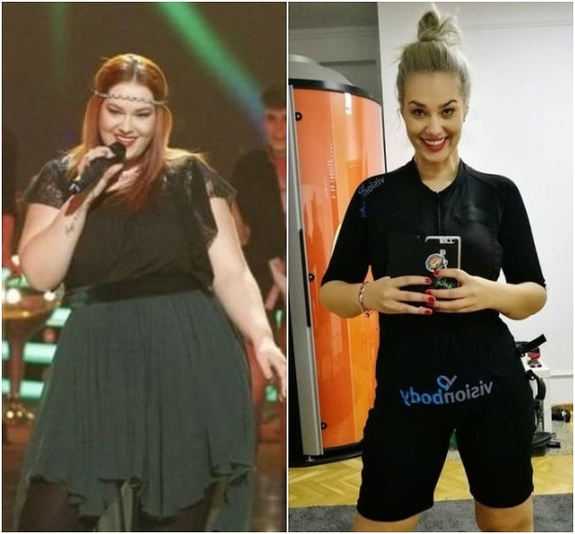 Vedetele din România care și-au tăiat stomacul. Imagini înainte și după operația de slăbit
