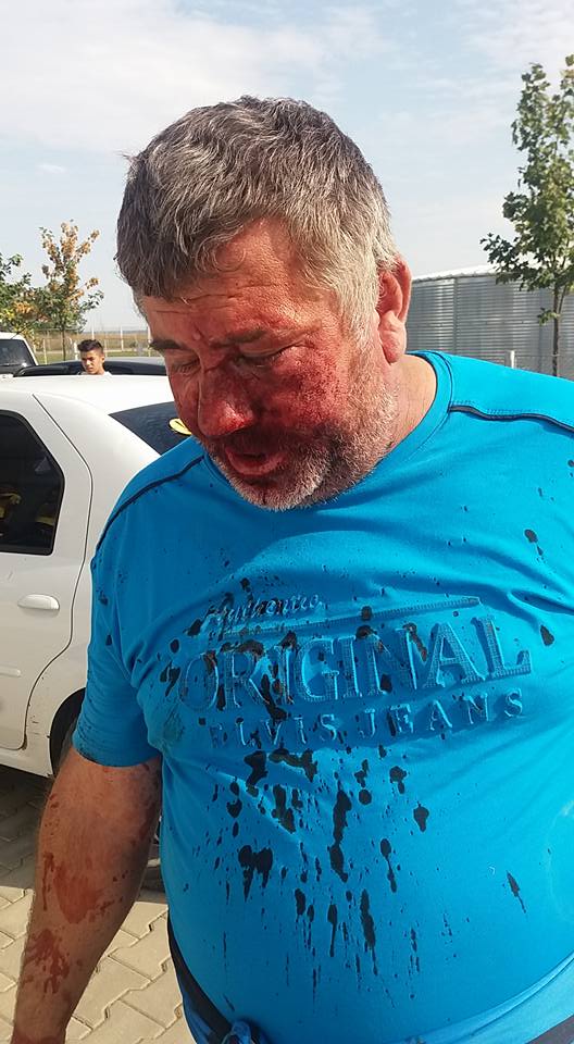 Un antrenor a fost umplut de sânge de rudele unui fotbalist. Imagini horror