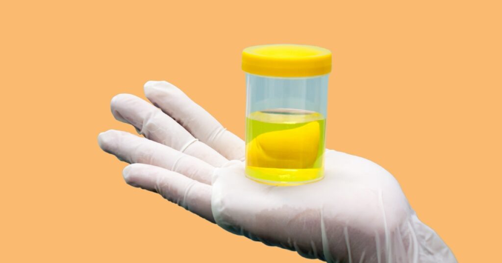 Urine is normally a shade of yellow [HumanBodyLearning]