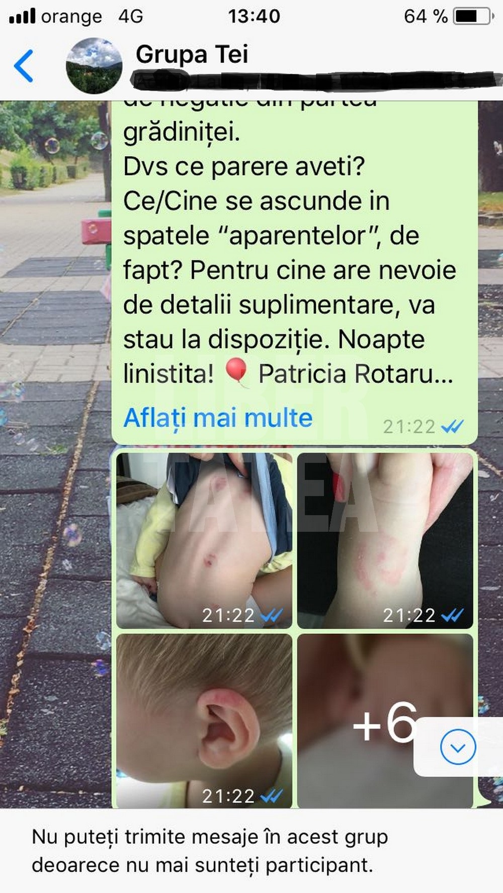 EXCLUSIV / Copil de 1 an și 8 luni, mușcat violent la grădiniță. Copilul a rămas cu traume