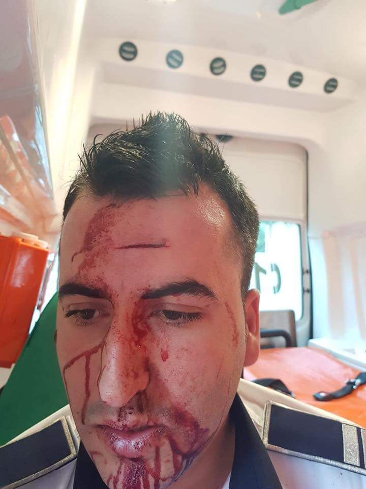 UPDATE. Polițist din Craiova, bătut cu telefonul mobil de un șofer pe care a încercat să-l rețină. Imagini șocante cu omul legii după agresiune