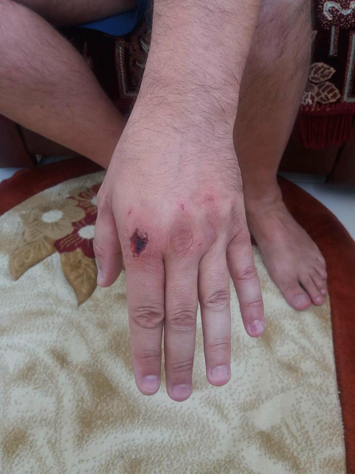 Un polițist din Piatra Neamț a fost bătut și lăsat fără încărcător. A primit pumni în cap pentru ca pistolul să nu ajungă la agresori