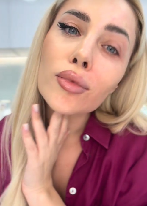Cum arată Oana Monea nemachiată. Și-a șters make-up-ul în fața fanilor ei: „Aud mereu același lucru: «Ai riduri! De ce nu le injectezi»”