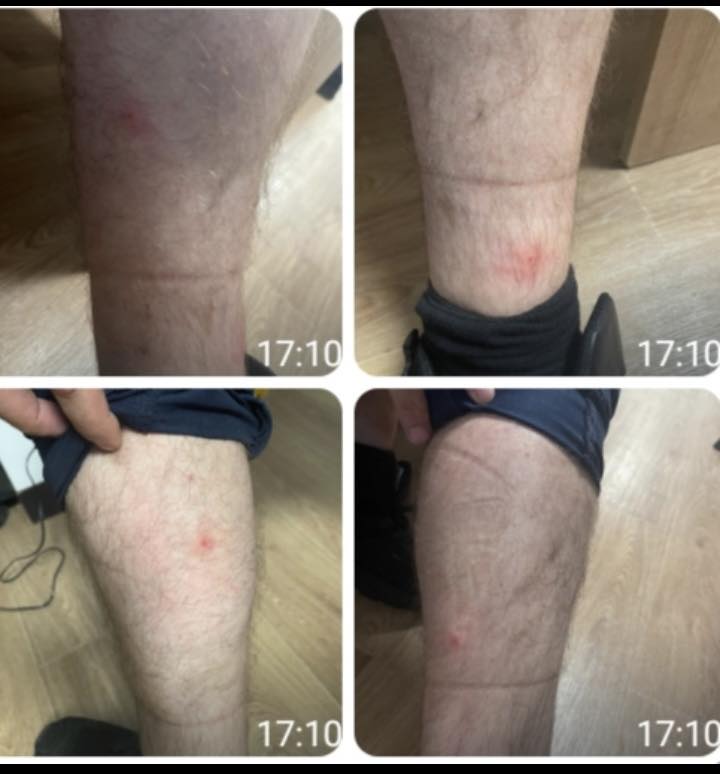 Școala de poliție din Câmpina cheltuie un milion de euro pentru a scăpa de ploșnițe. Insecta „cucerește” pe rând instituții de stat, iar funcționarii trăiesc un coșmar acasă