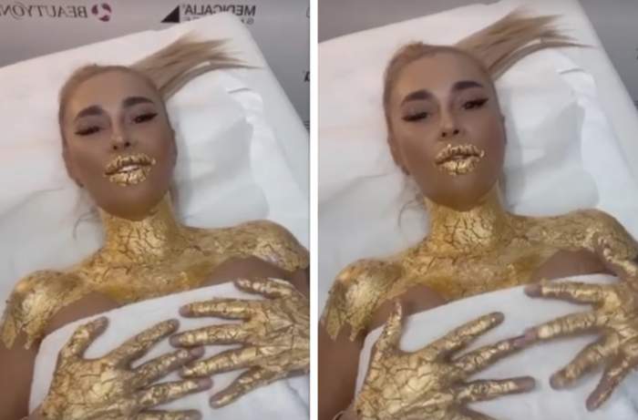 Anamaria Prodan, tratament pentru piele cu aur de 24K. „Vreau să vă arăt la final rezultatul”