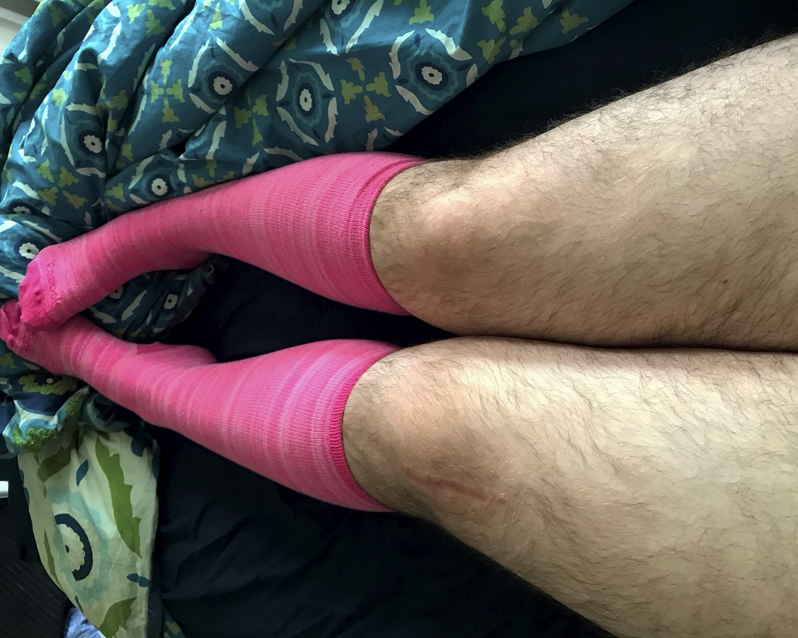 FOTO | Povestea femeii care nu s-a mai epilat de un an de zile