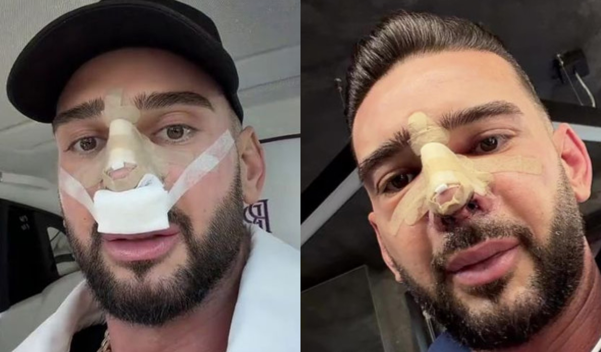 Cum se simte Dorian Popa după operația suferită la nas. „Dacă sunteți în context, nu vă speriați”