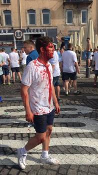 Euro 2016. Învinuită pentru masacrul de la Marsilia, UEFA amenință Anglia și Rusia cu excluderea! | Bilanțul bătăilor: un mort, 34 de răniți și 15 arestați